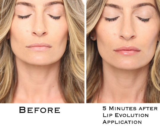 Lip Evolution Rx- Lip Filler Plumping Gloss