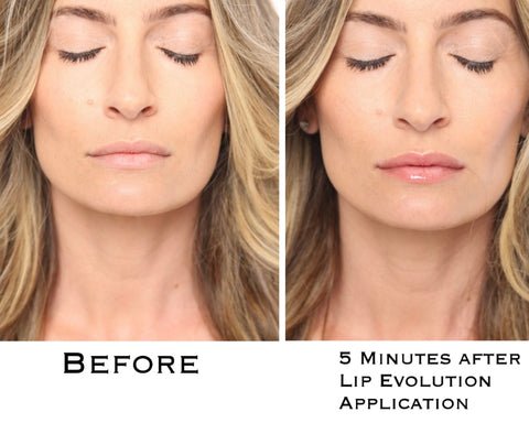 Lip Evolution Rx- Lip Filler Plumping Gloss