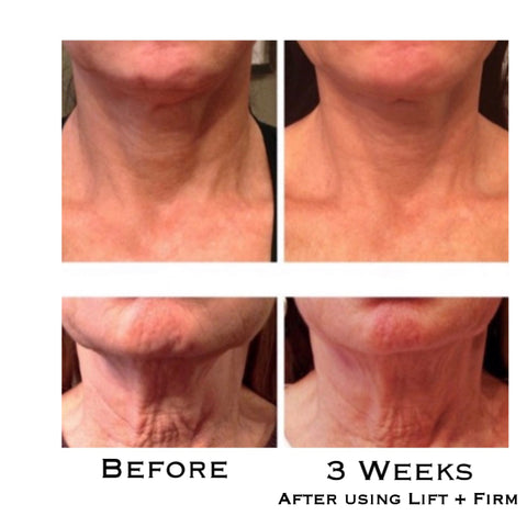 Lift + Firm Age Renewal Neck Cream