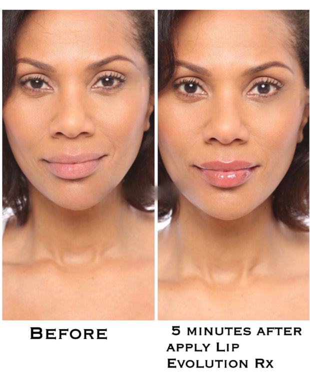 Lip Evolution Rx- Lip Filler Plumping Gloss