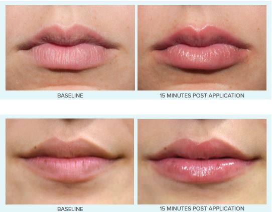 Lip Evolution Rx- Lip Filler Plumping Gloss