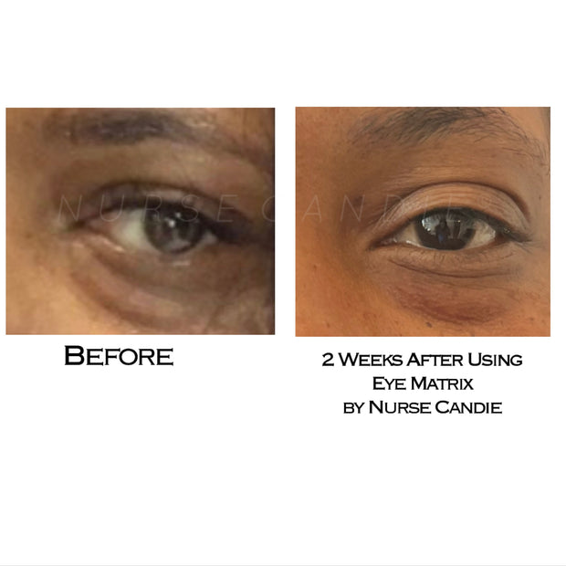 Eye Matrix Firm+Tighten+Brighten Age Defense